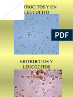 Sedimento-Urinario y Urianalisis