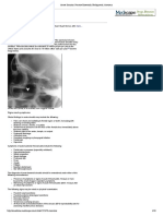 Acute Sinusitis - Practice Essentials, Background, Anatomy PDF