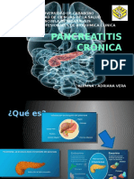 Pancreatitis Crónica 