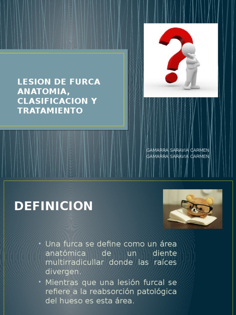 Clasificación y tratamiento de lesiones de furca | PDF