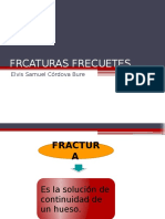 Fracturas