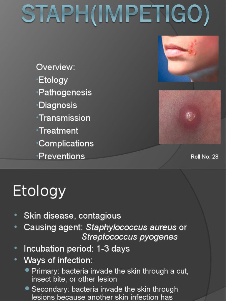 Impetigo Immunology Health Sciences