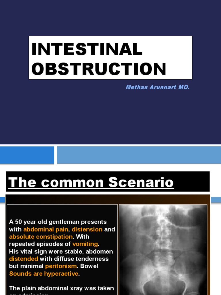 Intestinal Obstruction Guide | PDF | Digestive Diseases | Gastroenterology