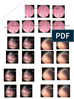 Thyroid Gland Thyroid Gland Thyroid Gland Thyroid Gland