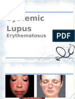 Systemic Lupus Erythematosus Sle