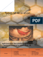 Types of Laceration and Bone Fracture