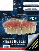 Alta Tecnica Dental - Placas Huecas