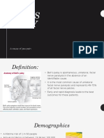 bells palsy