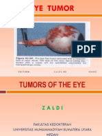 Tumor of The Eye