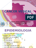 Cancer Vesical - PPTX Andrea