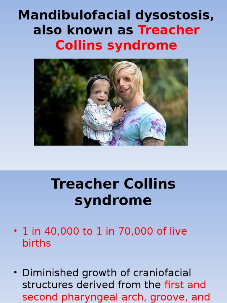 T Collins Syndrome | PDF | Human Head And Neck | Anatomy