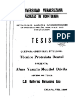 Tipos de Retenedores para PPR