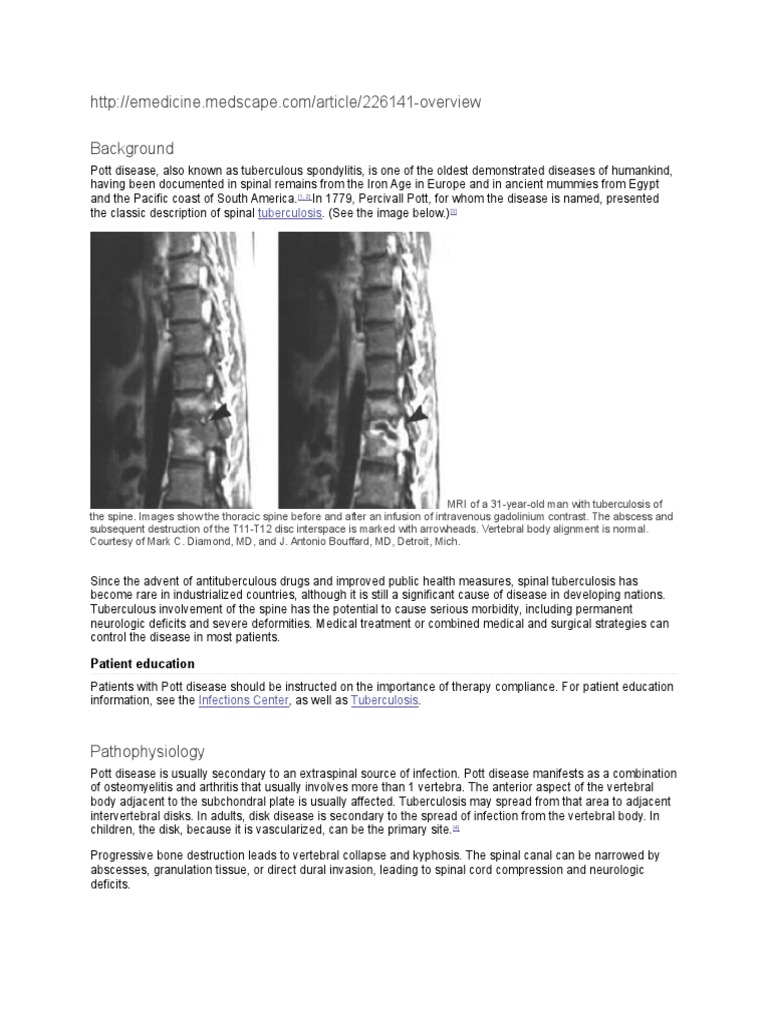 Pott's Disease Medscape Vertebral Column Pathology Free 30day