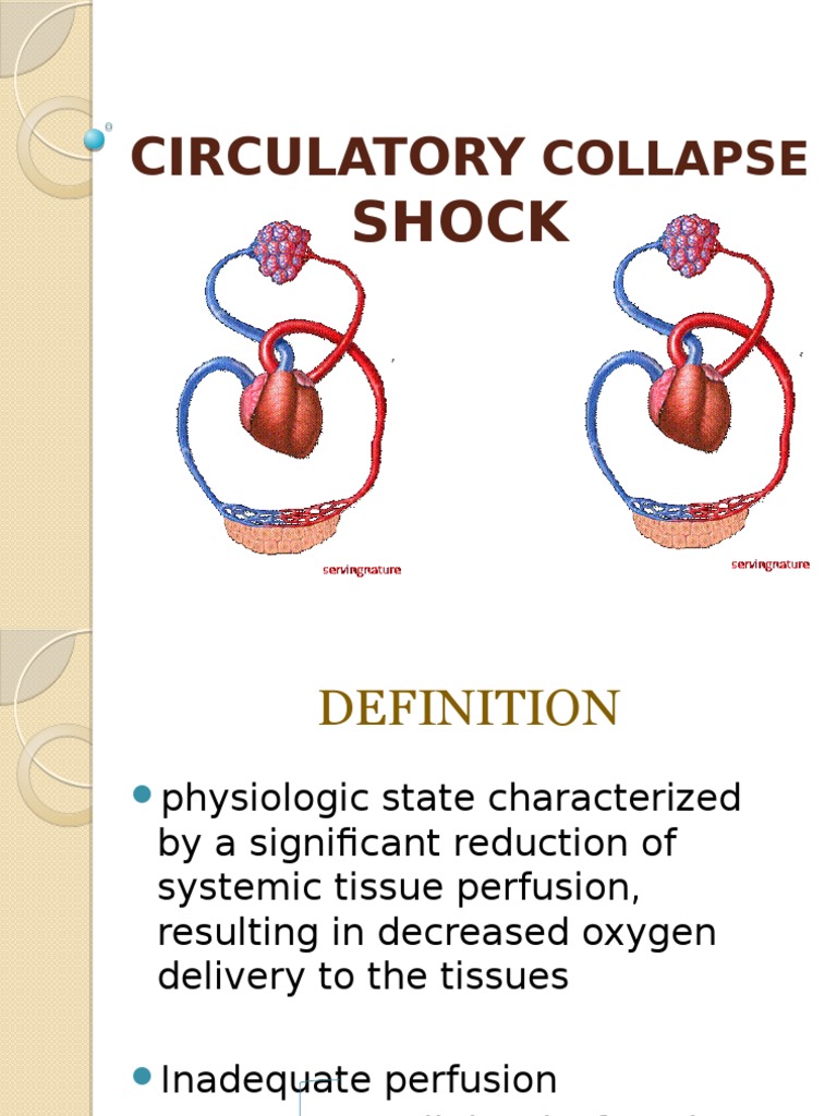 Shock Shock (Circulatory) Sepsis