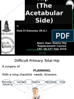 Difficult Primary Total Hip Arthroplasty (The Acetabular Side)