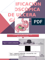 CLASIFICACION ENDOSCOPICA DE ULCERA GASTRICA - LISSETH Info