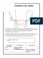 Sudut Acetabular