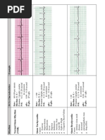 EKG Flash Cards PDF