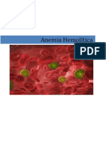 Anemia Hemolítica