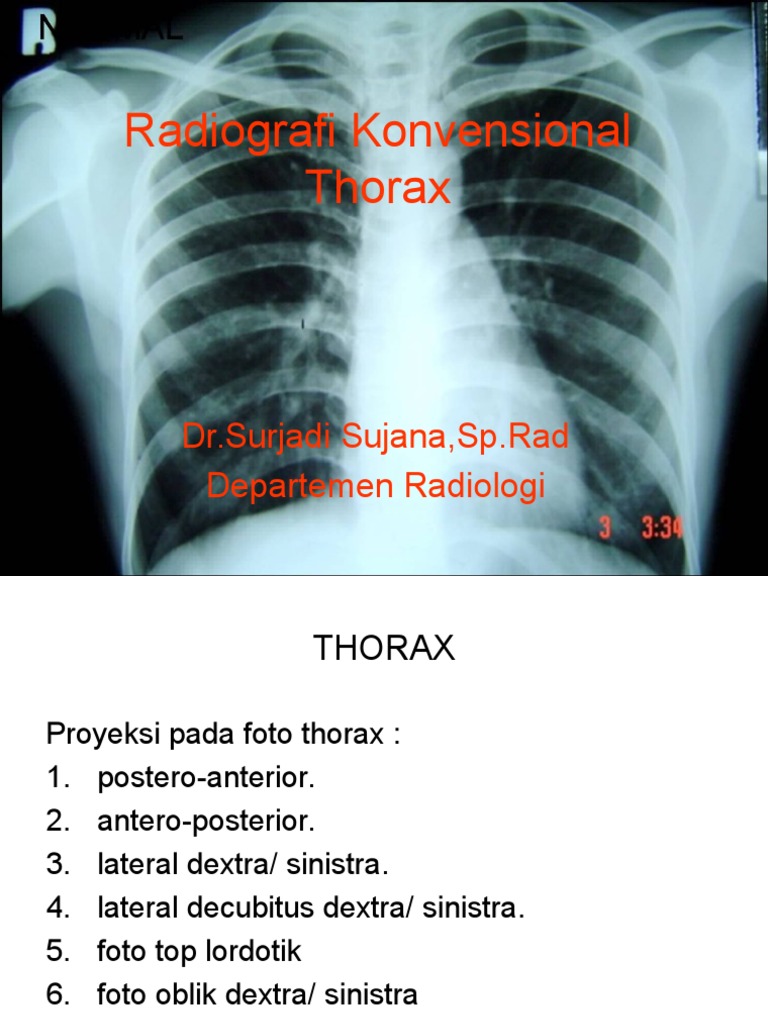 Proyeksi dan Analisis Foto Thorax | PDF | Sains & Matematika