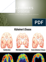 Alzheimer'S Disease: Amoranto - Azugue - Bamba - Caser - Nhiyam - Raymundo