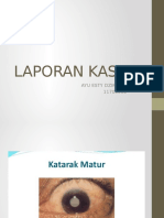 Lapsus Katarak Matur