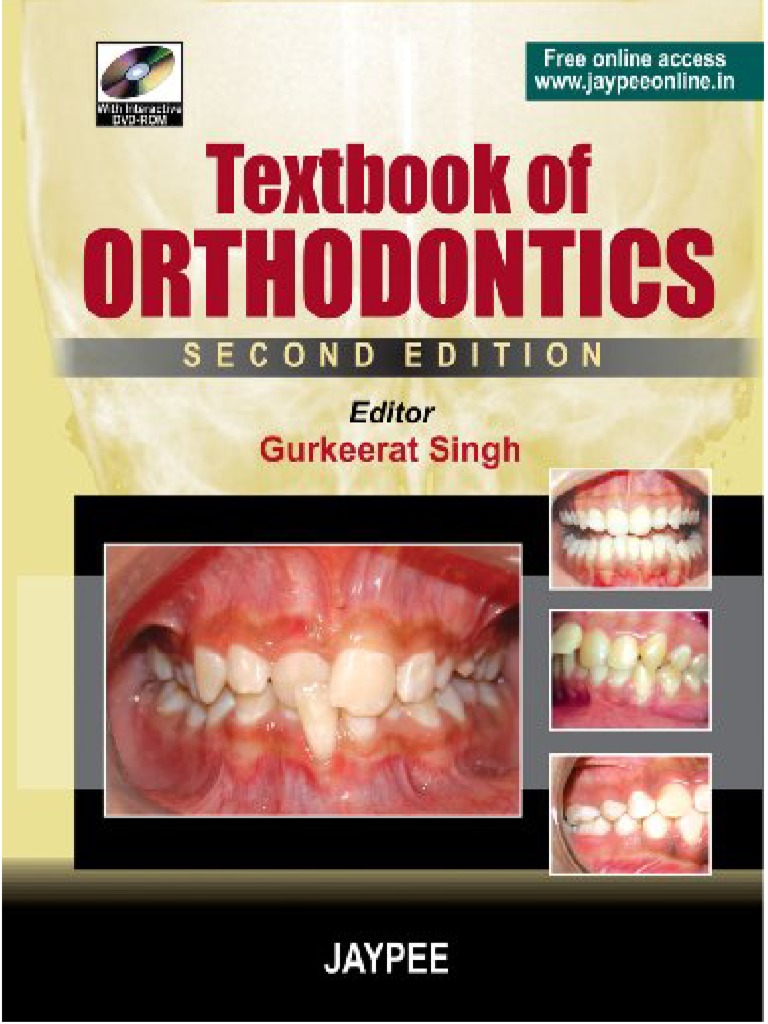 Textbook of Orthodontics Advance cases Orthodontics Wellness
