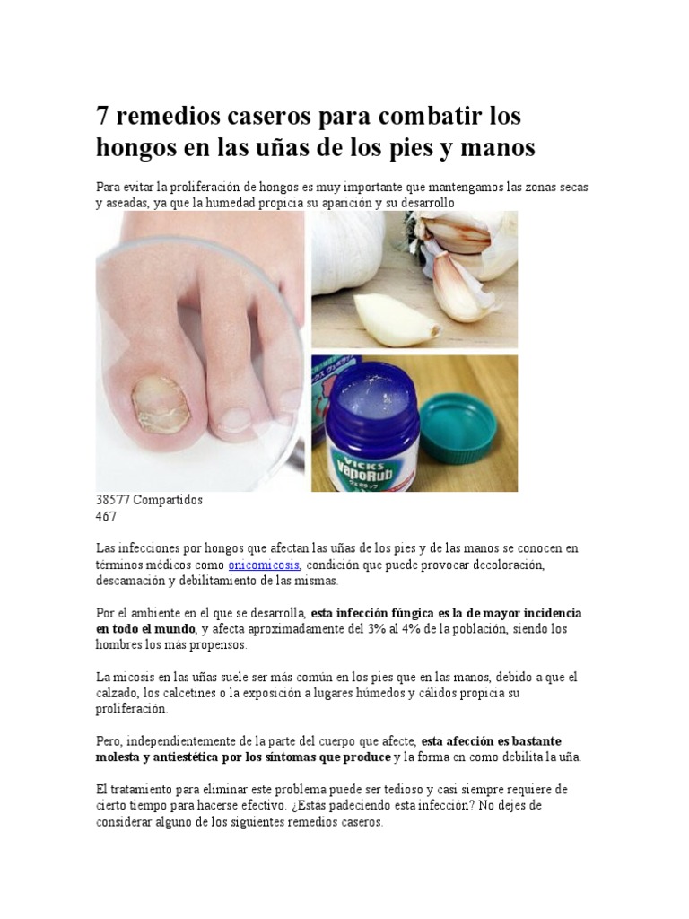 Hongos Uñas Pies Tratamiento Eficaz Casero