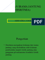 DISRITMIA