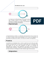 Defectos y Enfermedad Del Ojo