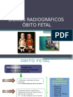 Signos-Radiograficos Obito Fetal