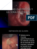 Úlceras Gástrica y Duodenal