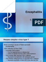IDEncephilitis