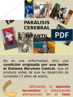 Parálisis Cerebral Infantil