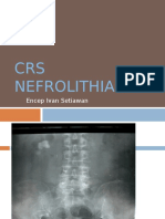 CRS Nefrolithiasis