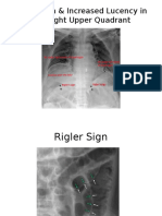 Tanda Tanda Radiologi (Perforasi Gaster)