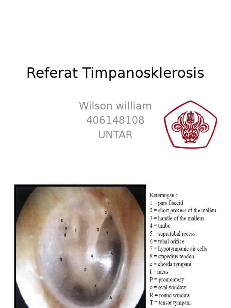 Timpanosklerosis: Diagnosis dan Penatalaksanaan | PDF