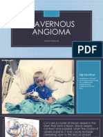 Cavernous Angioma - Visual Aid