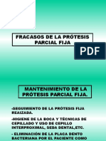 20 Fracasos en PPF