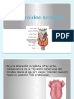 Tiroides ectópica.pptx