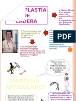 Artroplastia de Cadera IV