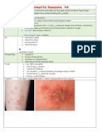 Dermatitis Numularis Print