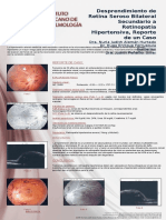 Cartel Anterior Segment Disgenesia