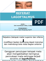 Lagoftalmus