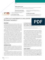 276 CIENCIA LesionGranTamano (1).Enero2016pdf