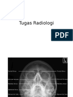 Tugas Radiologi Part 3