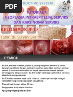 Download Kanker Serviks by Maydis stigma SN32027661 doc pdf