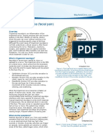 Trigeminal Neurlgia