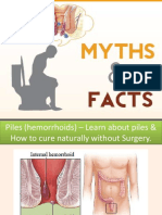 Piles (Hemorrhoids) – Learn About #Piles & How to Cure Naturally Without Surgery.