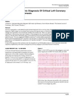 Electrocardiographic Diagnosis of Critical Left Coronary